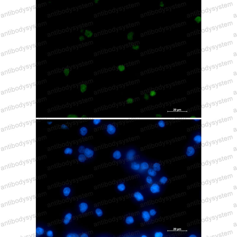 Валидация IF - AntibodySystem RHD64606