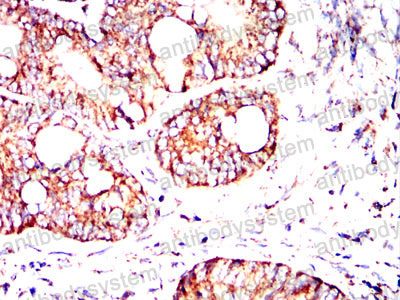 Валидация AntibodySystem RHC33503 (906)
