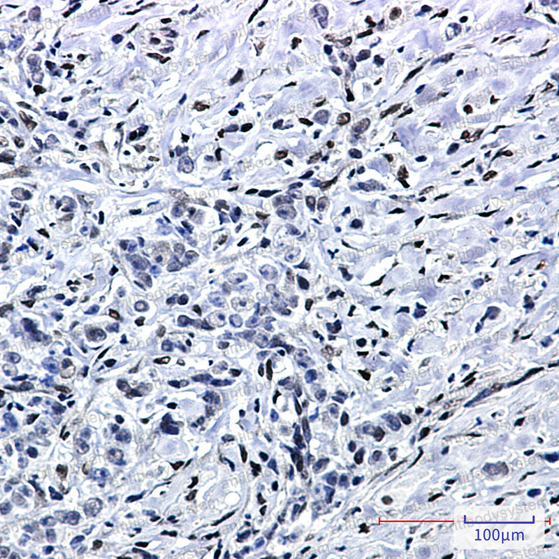 Валидация AntibodySystem RHK31001