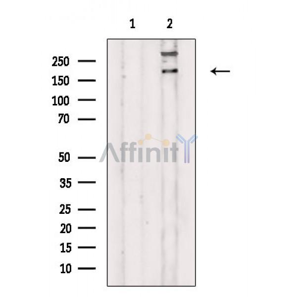 Валидация Affinity AF9121 - 4905