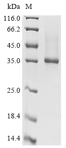 SDS-PAGE