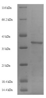 SDS-PAGE