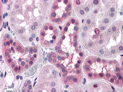 Валидация AntibodySystem RHD79503 (1824)