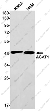 Вестерн-блоттинг, ACAT1, клетки K562 и HeLa