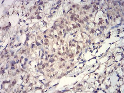 Валидация AntibodySystem RHJ11902