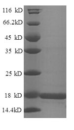SDS-PAGE