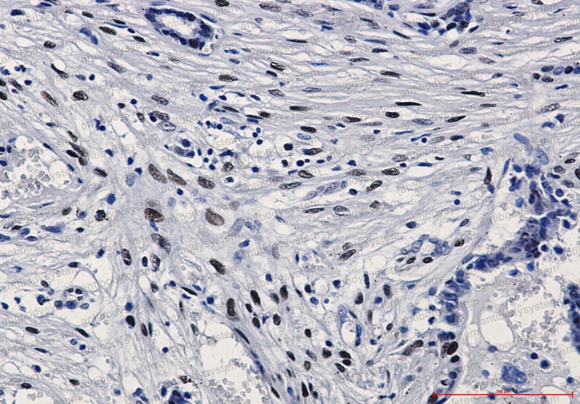 Валидация AntibodySystem RHC16503