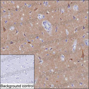 Валидация AntibodySystem RHH20602
