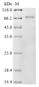 SDS-PAGE