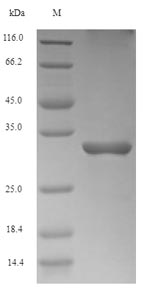 SDS-PAGE