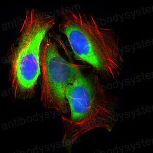 Валидация IF - AntibodySystem RHD06202 (511)