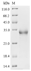 SDS-PAGE