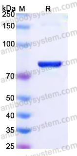 EHK84902, SDS-PAGE