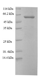 SDS-PAGE