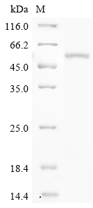 SDS-PAGE