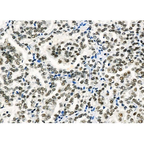 Валидация Affinity DF3887 - 15049