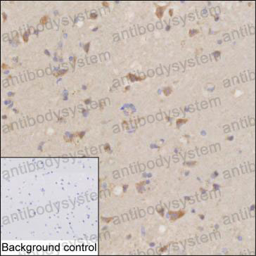 Валидация AntibodySystem RHJ12902