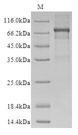SDS-PAGE