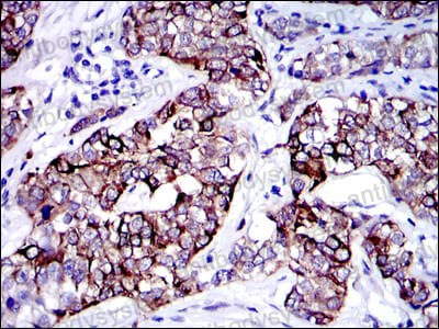 Валидация AntibodySystem RHC36006