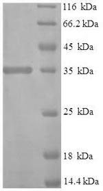 SDS-PAGE