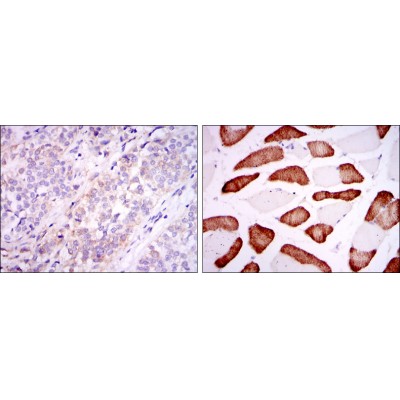 Валидация Affinity BF0058 - 5115