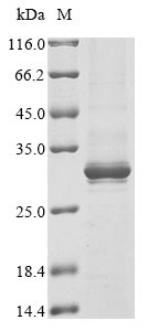 SDS-PAGE