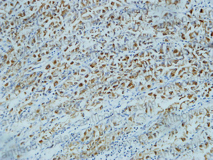 Валидация AntibodySystem RHD50005 (1616)