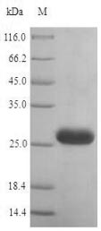 SDS-PAGE