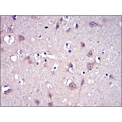 Валидация Affinity BF0560 - 5294