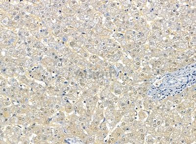 Валидация Affinity DF14237 - 10086