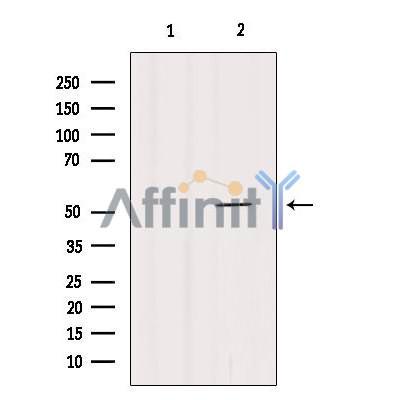 Валидация Affinity AF6074 - 3279