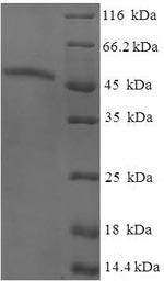 SDS-PAGE