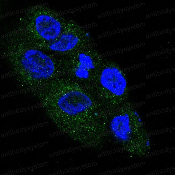 Валидация IF - AntibodySystem RHB91701
