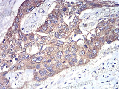 Валидация AntibodySystem RHK69201