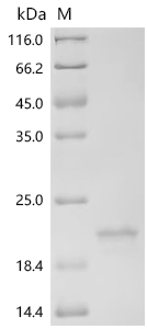 SDS-PAGE