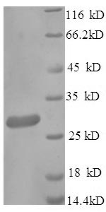 SDS-PAGE