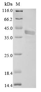 SDS-PAGE