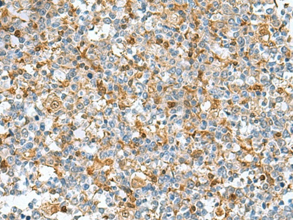Иммуногистохимия, DNPH1, ткань миндалин человека