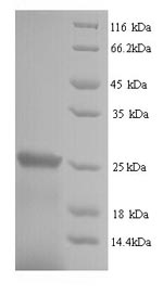 SDS-PAGE