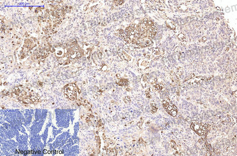 Валидация AntibodySystem RHD50005 (1613)