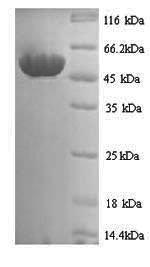 SDS-PAGE