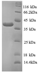 SDS-PAGE