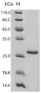 SDS-PAGE