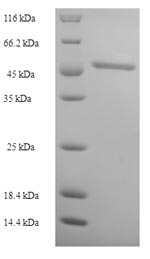 SDS-PAGE