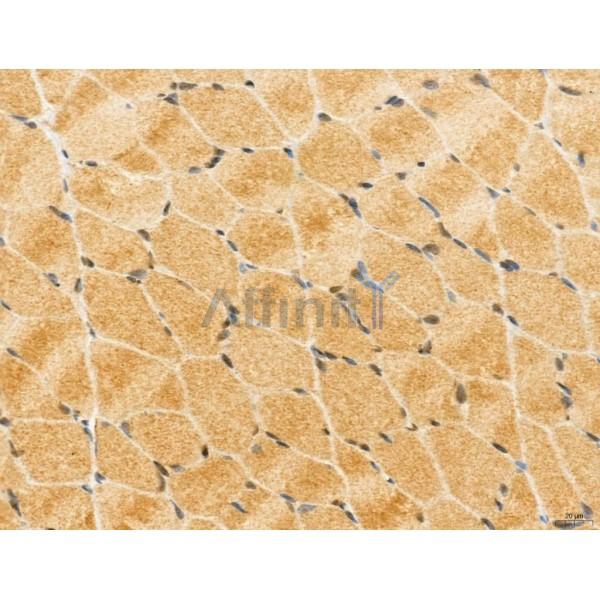 Валидация Affinity DF12139 - 6313