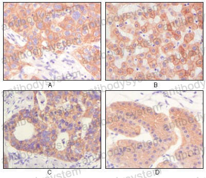 Валидация AntibodySystem RHC99505