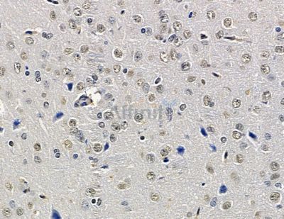 Валидация Affinity DF15585 - 12001