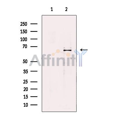 Валидация Affinity DF13520 - 8928