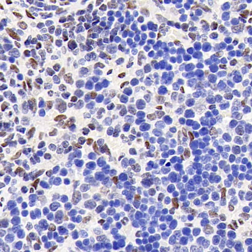 Иммуногистохимия, Glucocorticoid Receptor, ткань селезенки крысы