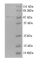 SDS-PAGE